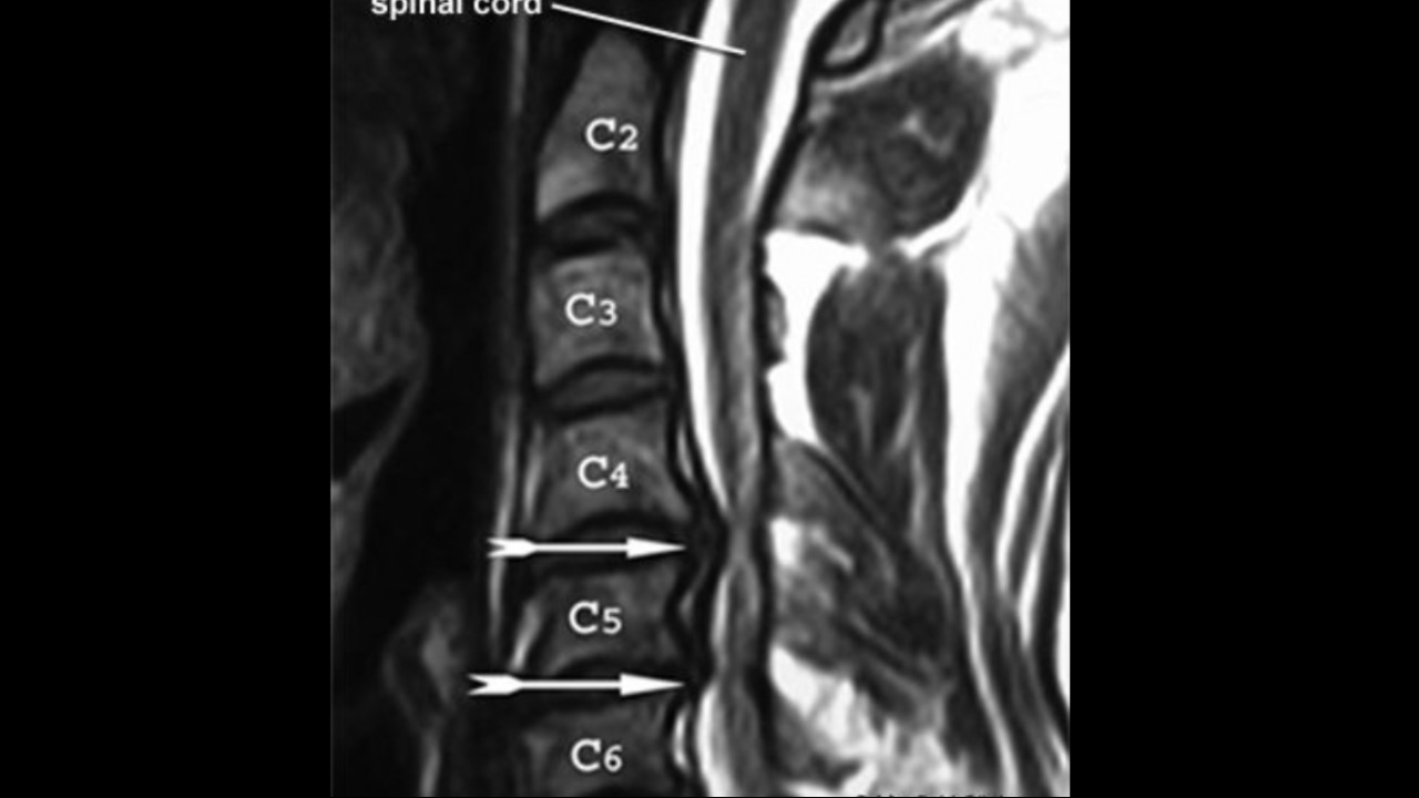 Help with medical bills and travels to and from doctors visit’s